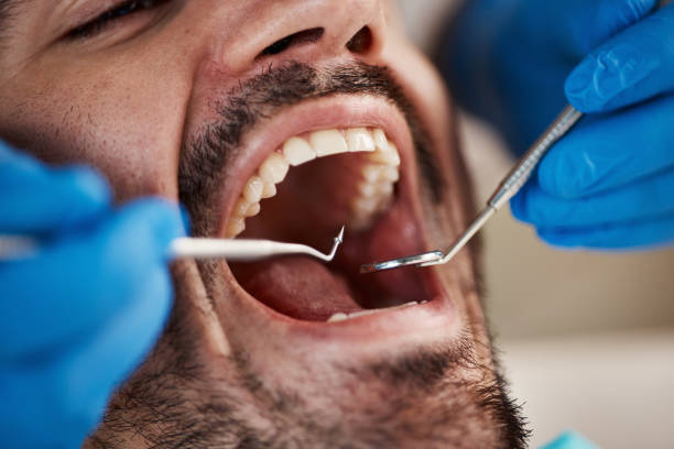 Best Broken Tooth Emergency  in Old Westbury, NY